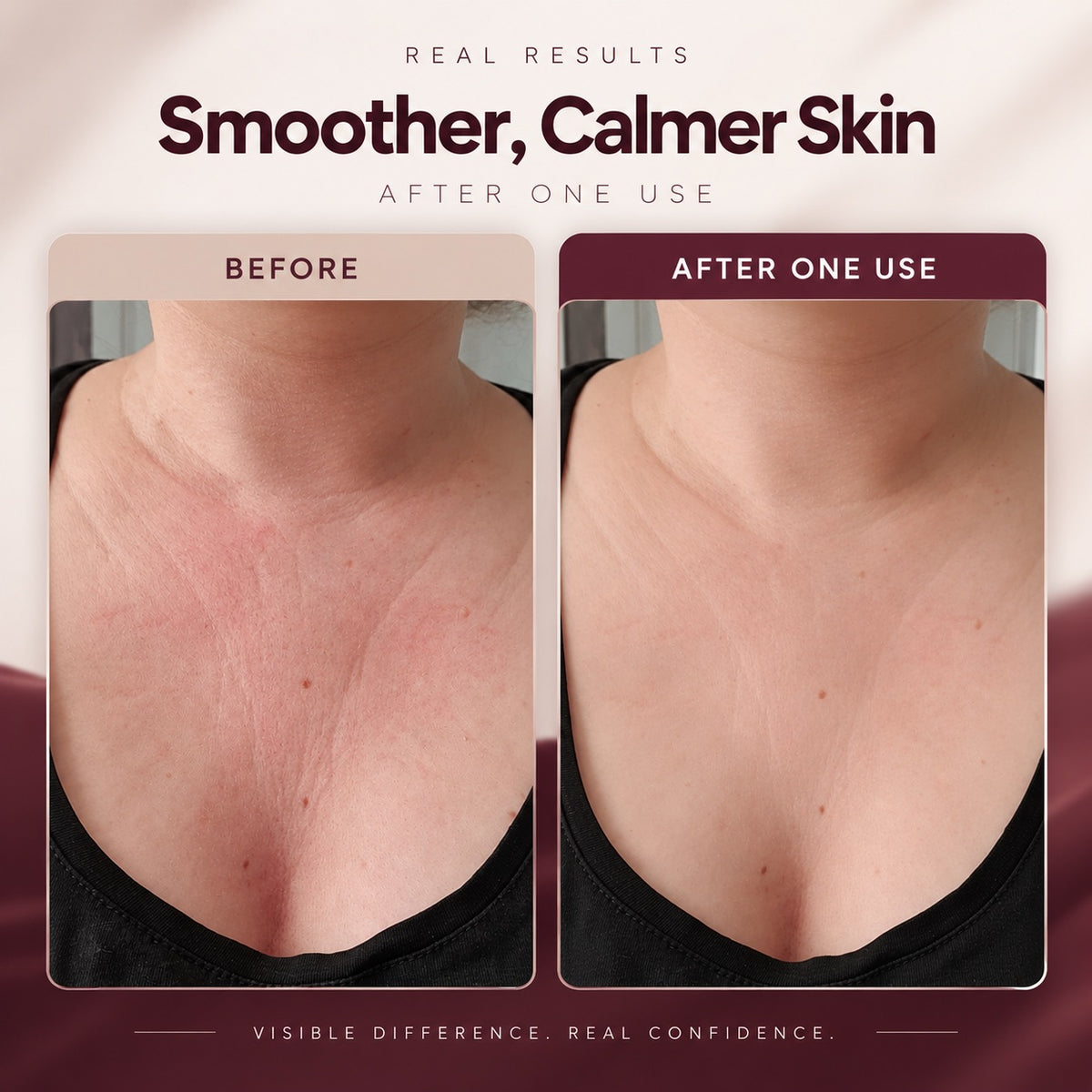 Chest Wrinkle Patch